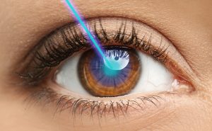 Lasik surgeon near Lake Forest, California discusses what makes you a good candidate for this procedure