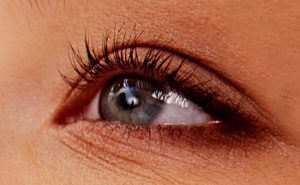 Patients in Lake Forest, CA, 92630, ask eye doctor, “What is surfer’s eye?”